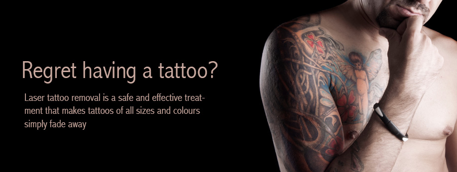 Remove Tattoos with Laser Tattoo Removal Birmingham, UK